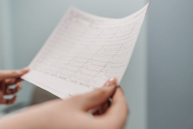 Normál EKG értékek: Egy egészséges szív mérései és magyarázataik